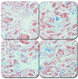 StatLab&nbsp;MasterTech Alkaline Congo Red Amyloid Special Stain Kit