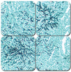 StatLab&nbsp;MasterTech G. M. S. Special Stain Kit