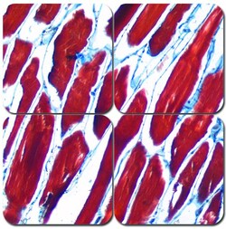 StatLab&nbsp;MasterTech Mallory's Trichrome Stain Kit