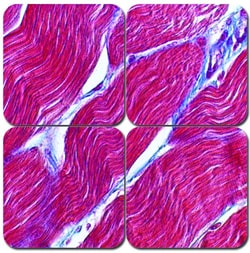 StatLab&nbsp;MasterTech Trichrome Special Stain Kit - Masson's