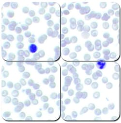 StatLab Wright-Giemsa Stain Kit Statlab&trade; Parasite Stain | Buy Online | StatLab | Fisher Scientific