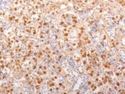 ACTH Antibody (2F6) - N-terminal - Azide and BSA Free, Novus Biologicals