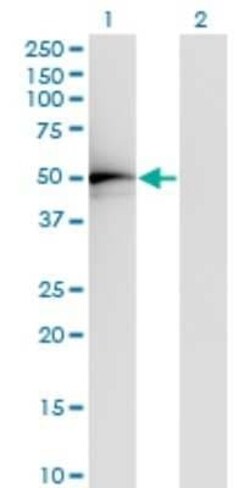 ADA2a Antibody (4A8-1A7), Novus Biologicals 0.1 mg | Buy Online | Novus Biologicals | Fisher Scientific
