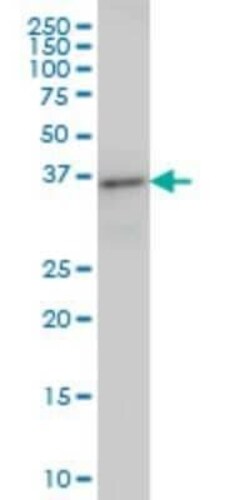 ARFIP2 Antibody (2B5), Novus Biologicals 0.1 mg | Buy Online | Novus Biologicals | Fisher Scientific