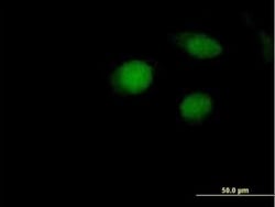 ARL4 Antibody, Novus Biologicals 0.05 mg | Buy Online | Novus Biologicals | Fisher Scientific