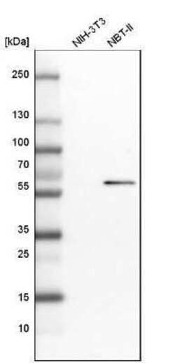 BAIAP2L1 Antibody, Novus Biologicals 0.1 mL | Buy Online | Novus Biologicals | Fisher Scientific