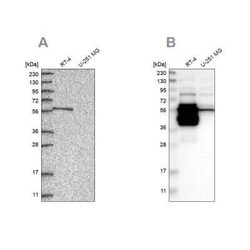BAIAP2L1 Antibody, Novus Biologicals 0.1 mL | Buy Online | Novus Biologicals | Fisher Scientific