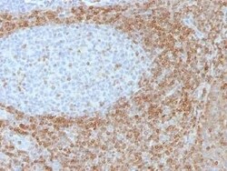 Bcl-2 Antibody (SPM530) - Azide and BSA Free, Novus Biologicals 0.1 mg | Buy Online | Novus Biologicals | Fisher Scientific