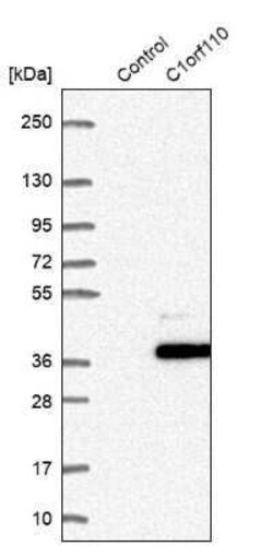 CCDC190 Antibody, Novus Biologicals 0.1 mL | Buy Online | Novus Biologicals | Fisher Scientific