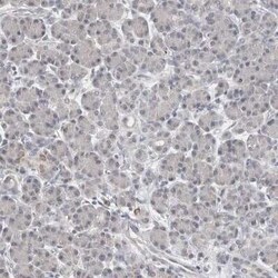 CARKL Antibody, Novus Biologicals 0.1 mL | Buy Online | Novus Biologicals | Fisher Scientific