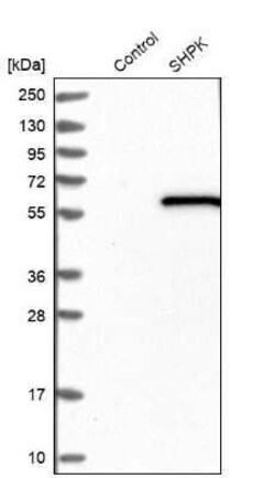 CARKL Antibody, Novus Biologicals 0.1 mL | Buy Online | Novus Biologicals | Fisher Scientific