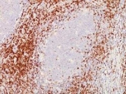 CD5 Antibody (C5/473 + CD5/54/F6) - Azide and BSA Free, Novus Biologicals