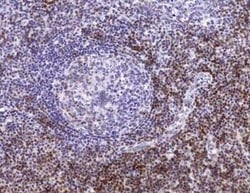 CD5 Antibody (C5/473 + CD5/54/F6) - Azide and BSA Free, Novus Biologicals