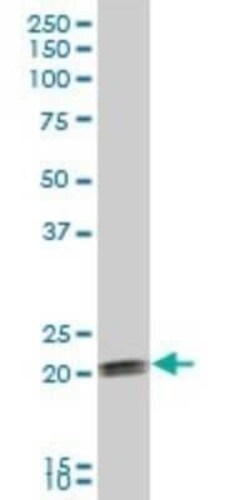 COPS8 Antibody, Novus Biologicals 0.05 mg | Buy Online | Novus Biologicals | Fisher Scientific