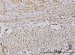 CXCL5/ENA-78 Antibody (2A9), Novus Biologicals 0.05 mg; Unconjugated:Antibodies,