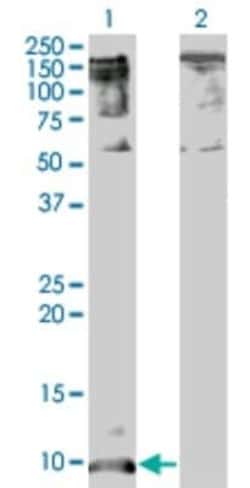 CXCL5/ENA-78 Antibody (2A9), Novus Biologicals 0.05 mg; Unconjugated:Antibodies,