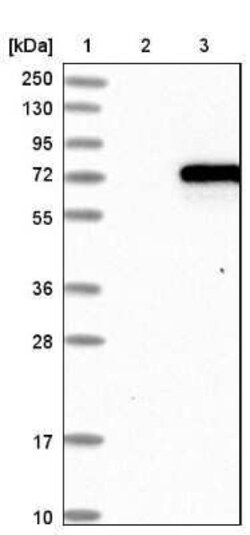 CaMKK alpha Antibody, Novus Biologicals 0.1 mL | Buy Online | Novus Biologicals | Fisher Scientific