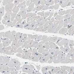 Calsequestrin 1 Antibody, Novus Biologicals 0.1 mL, Unconjugated:Antibodies,