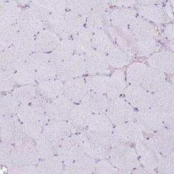 Cytochrome P450 2A6 Antibody, Novus Biologicals 25 &mu;L; Unconjugated:Antibodies,
