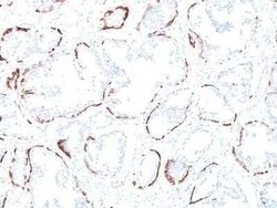 Cytokeratin, HMW Antibody (34BE12) - Azide and BSA Free, Novus Biologicals 0.1 mg | Buy Online | Novus Biologicals | Fisher Scientific
