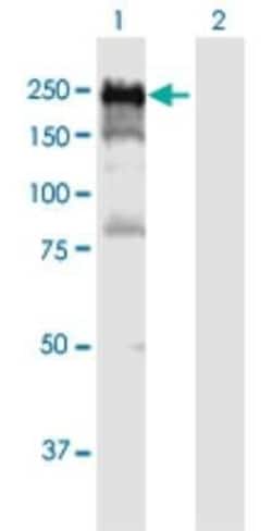 DLC1 Antibody, Novus Biologicals 0.05 mg, Unconjugated:Antibodies, Polyclonal