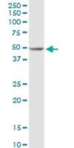 DNA polymerase delta p50 Antibody, Novus Biologicals 0.1 mg | Buy Online | Novus Biologicals | Fisher Scientific