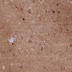 DPYSL4 Antibody, Novus Biologicals 0.1 mL | Buy Online | Novus Biologicals | Fisher Scientific