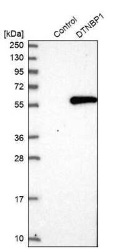 Dysbindin Antibody, Novus Biologicals 0.1 mL | Buy Online | Novus Biologicals | Fisher Scientific