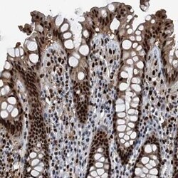 FKBP51/FKBP5 Antibody, Novus Biologicals 0.1 mL, Unconjugated:Anticuerpos