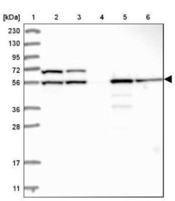 FKBP51/FKBP5 Antibody, Novus Biologicals 0.1 mL, Unconjugated:Anticuerpos