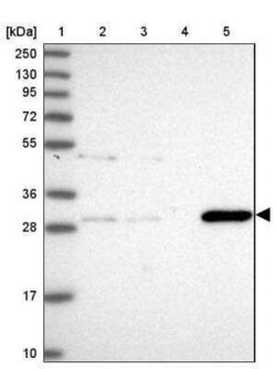 GSTO2 Antibody, Novus Biologicals 0.1 mL | Buy Online | Novus Biologicals | Fisher Scientific