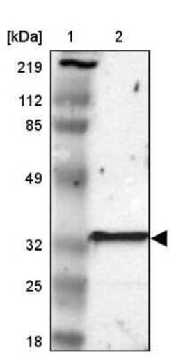 GSTT2B Antibody, Novus Biologicals 0.1 mL | Buy Online | Novus Biologicals | Fisher Scientific