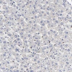 Galectin-3 Antibody, Novus Biologicals 0.1 mL; Unconjugated:Antibodies,