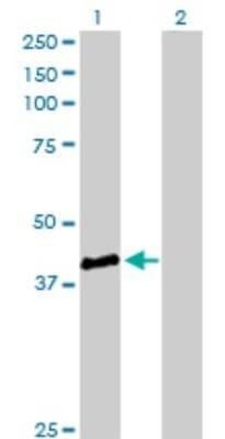 Genethonin 1 Antibody, Novus Biologicals 0.1 mg | Buy Online | Novus Biologicals | Fisher Scientific
