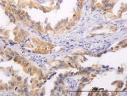 Hsp47 Antibody (1D2-1A6), Novus Biologicals 0.1 mg, Unconjugated:Antibodies,