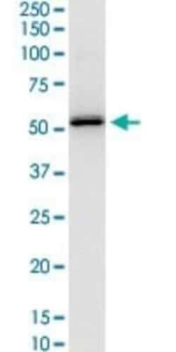 Hsp47 Antibody (1D2-1A6), Novus Biologicals 0.1 mg, Unconjugated:Antibodies,