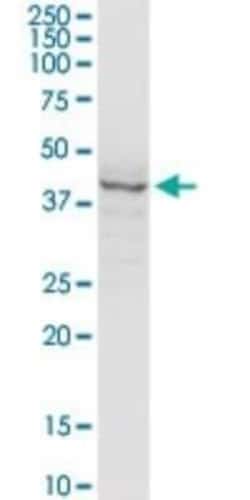 Hsp47 Antibody (1D2-1A6), Novus Biologicals 0.1 mg, Unconjugated:Antibodies,