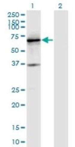 IA-2/PTPRN Antibody (8E3), Novus Biologicals 0.1 mg | Buy Online | Novus Biologicals | Fisher Scientific