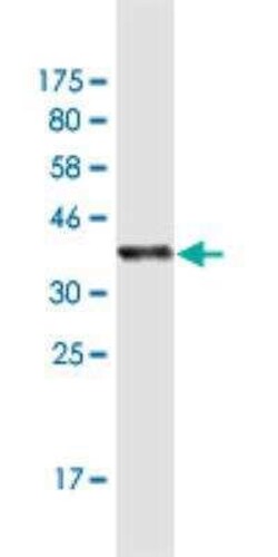 IA-2/PTPRN Antibody (8E3), Novus Biologicals 0.1 mg | Buy Online | Novus Biologicals | Fisher Scientific