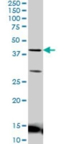LEF1 Antibody (5A3), Novus Biologicals 0.1 mg | Buy Online | Novus Biologicals | Fisher Scientific