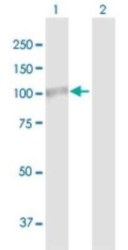 Lysine Hydroxylase 2/PLOD2 Antibody, Novus Biologicals 0.05 mg | Buy Online | Novus Biologicals | Fisher Scientific