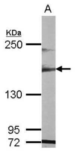 MAST1 Antibody, Novus Biologicals 0.1 mL | Buy Online | Novus Biologicals | Fisher Scientific