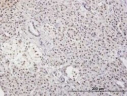 MLF2 Antibody (2F6-1E3), Novus Biologicals 0.1 mg | Buy Online | Novus Biologicals | Fisher Scientific