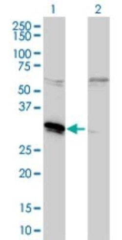 MLF2 Antibody (2F6-1E3), Novus Biologicals 0.1 mg | Buy Online | Novus Biologicals | Fisher Scientific