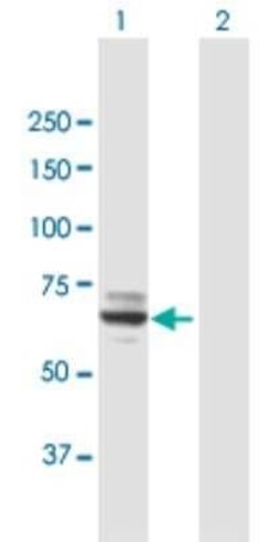 MOXD1 Antibody, Novus Biologicals 0.05 mg | Buy Online | Novus Biologicals | Fisher Scientific
