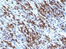 Myogenin Antibody (MGN185 + F5D) - Azide and BSA Free, Novus Biologicals