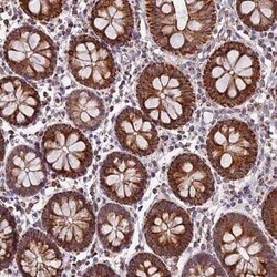 NDUFA8 Antibody, Novus Biologicals 0.1 mL | Buy Online | Novus Biologicals | Fisher Scientific