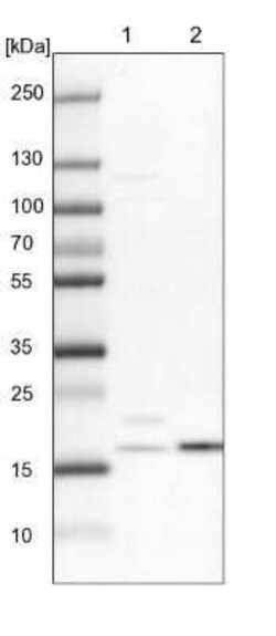 NDUFA8 Antibody, Novus Biologicals 0.1 mL | Buy Online | Novus Biologicals | Fisher Scientific