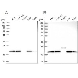 NDUFA8 Antibody, Novus Biologicals 0.1 mL | Buy Online | Novus Biologicals | Fisher Scientific