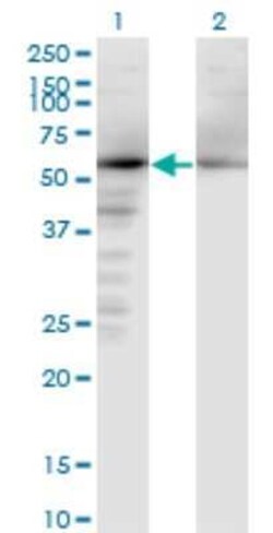 APPBP1 Antibody (2E9-D12), Novus Biologicals 0.1 mg, Unconjugated:Antibodies,
